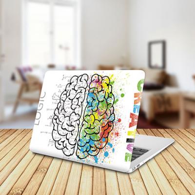 MacBook Case XC-304